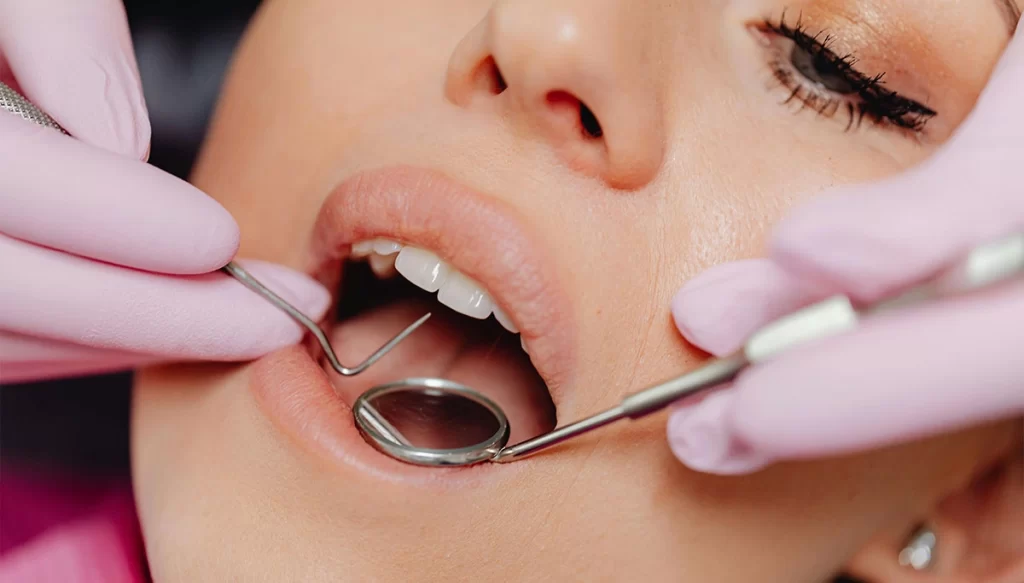 teeth cleanings