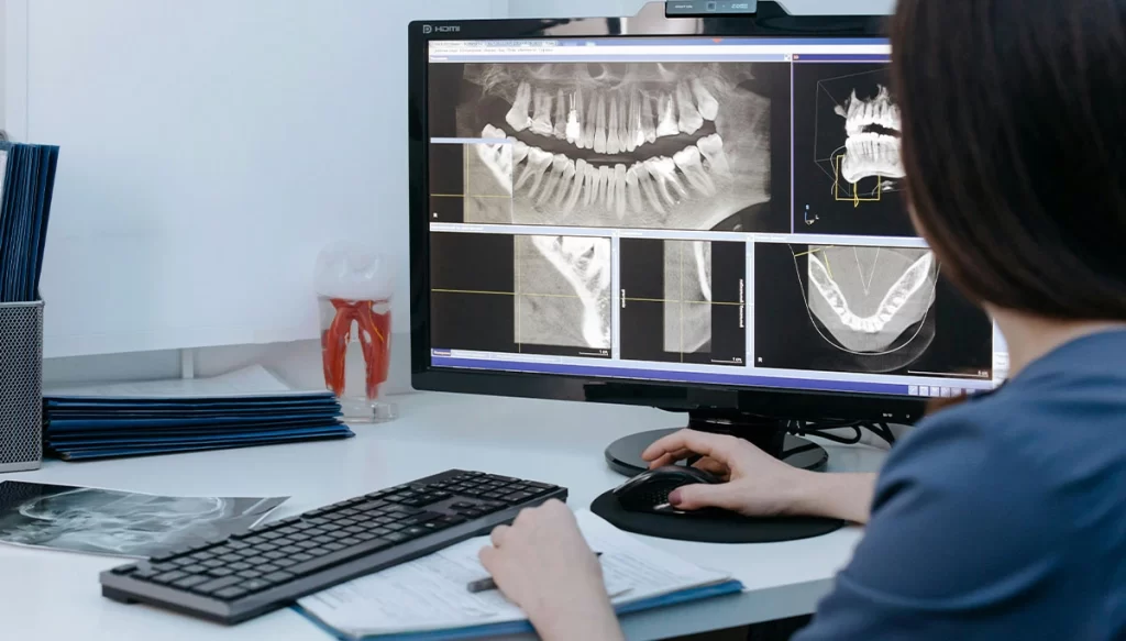 dental x-rays