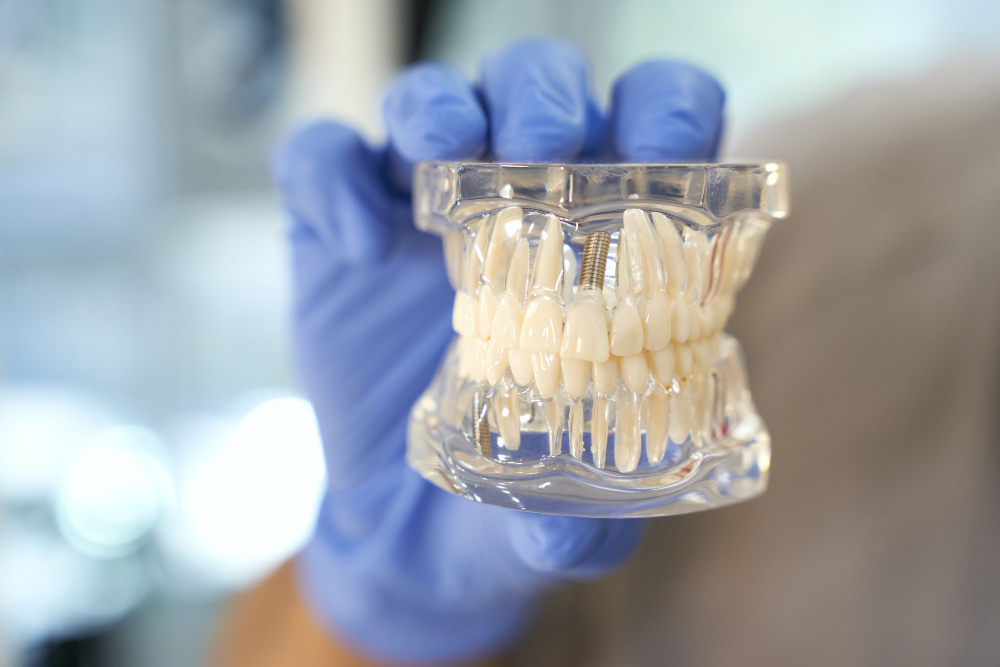 Restorative Dentistry