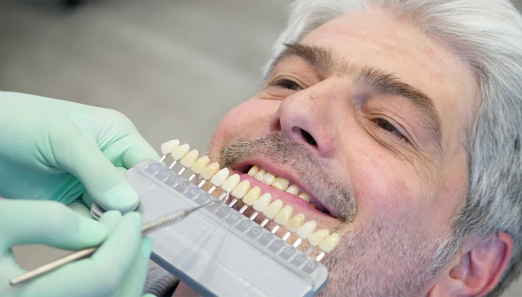 man smiling looking at dentist who has a rack of veneers infront of him