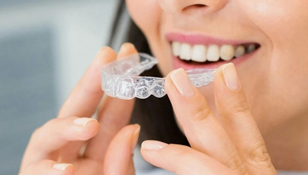 woman smiling before wearing braces