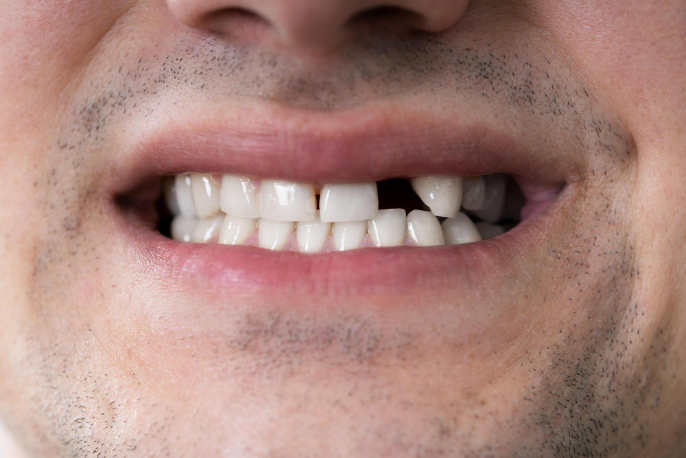 Emergency Dentist